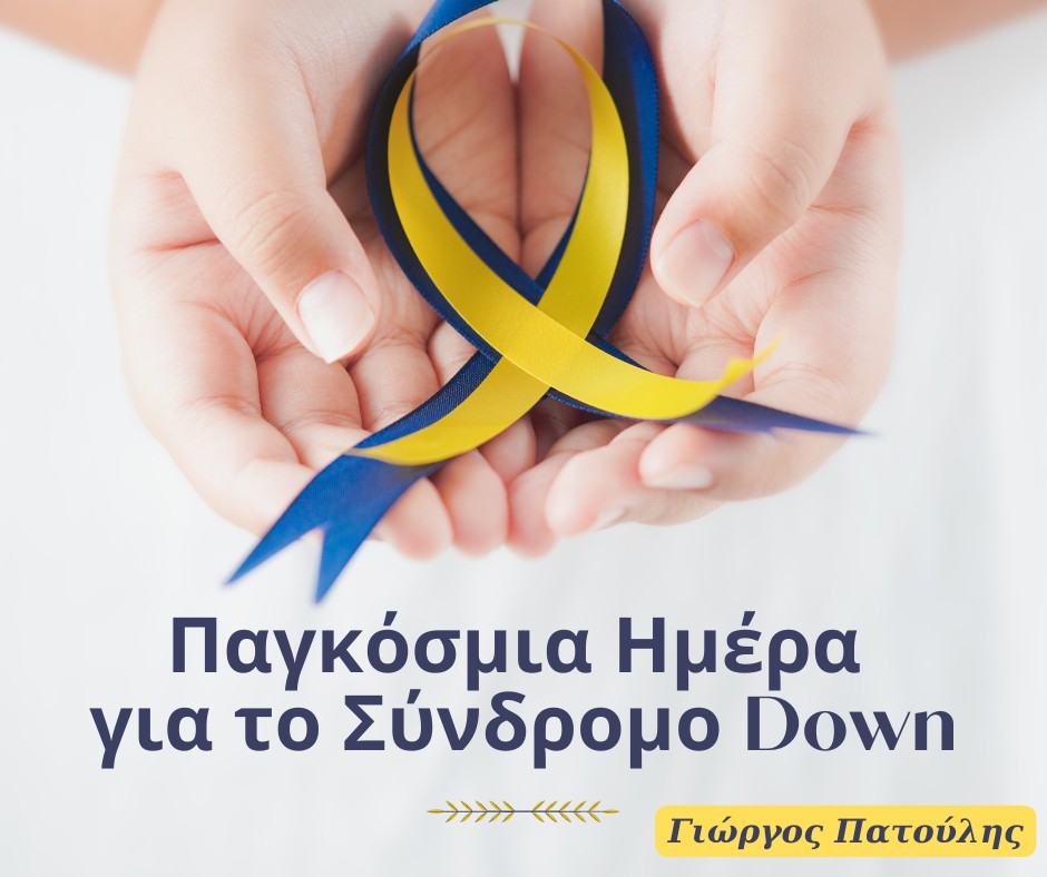 down syndrom n